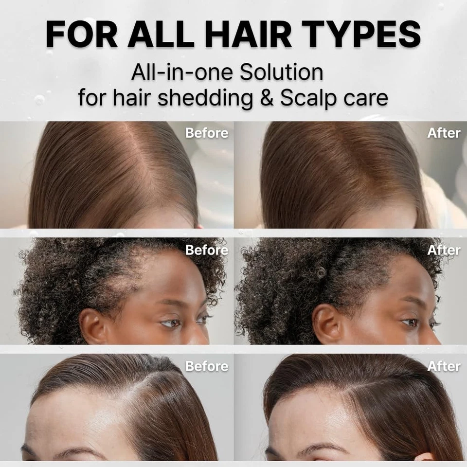 Kera-Shine Hair Growth Serum