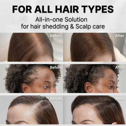 Kera-Shine Hair Growth Serum